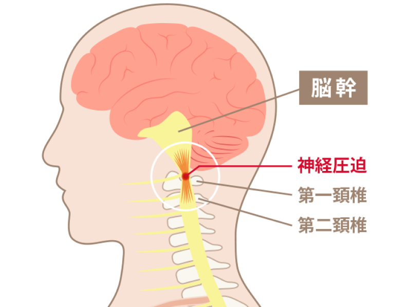 頚椎イメージ図