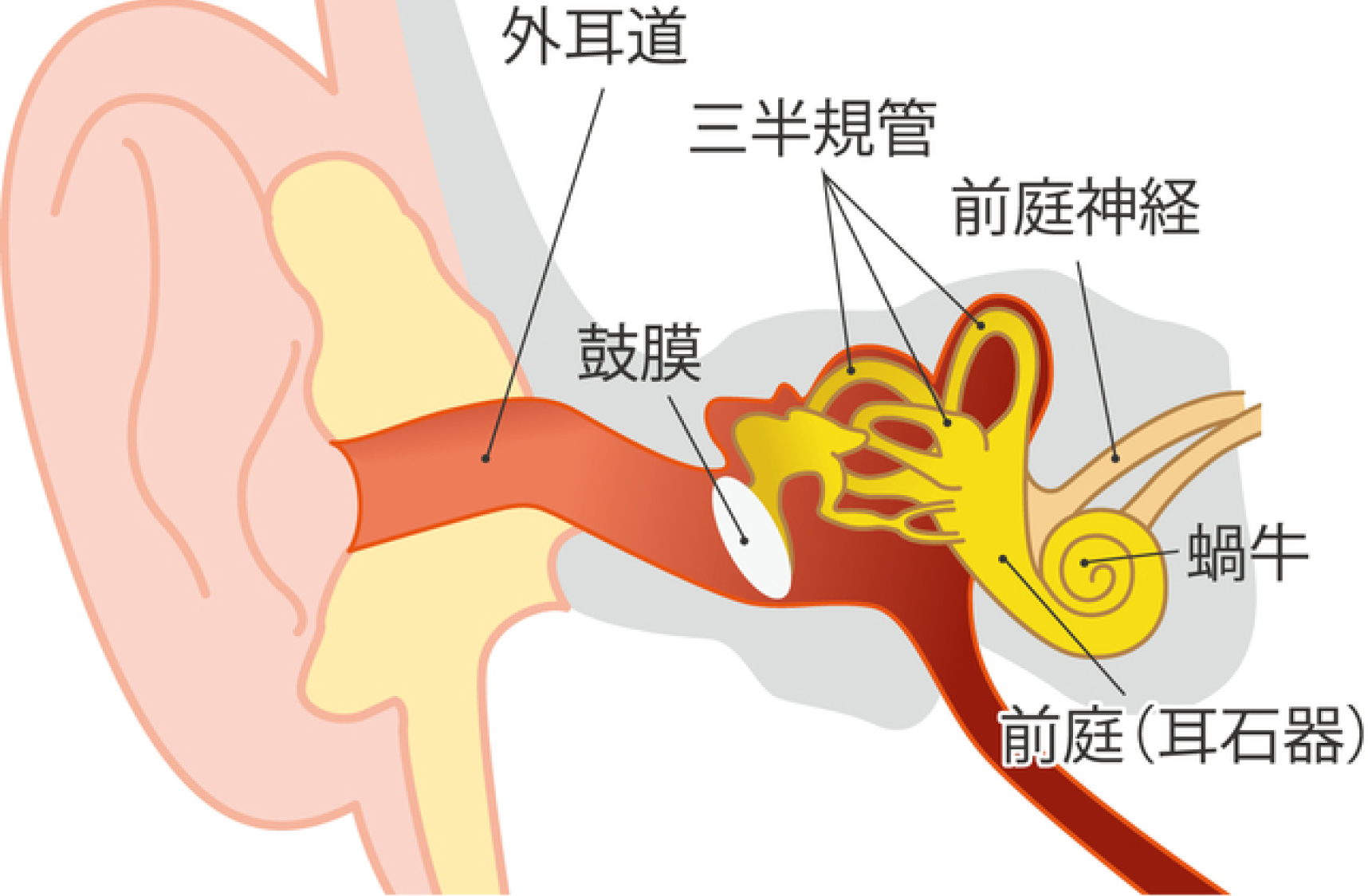 難聴説明イメージ図