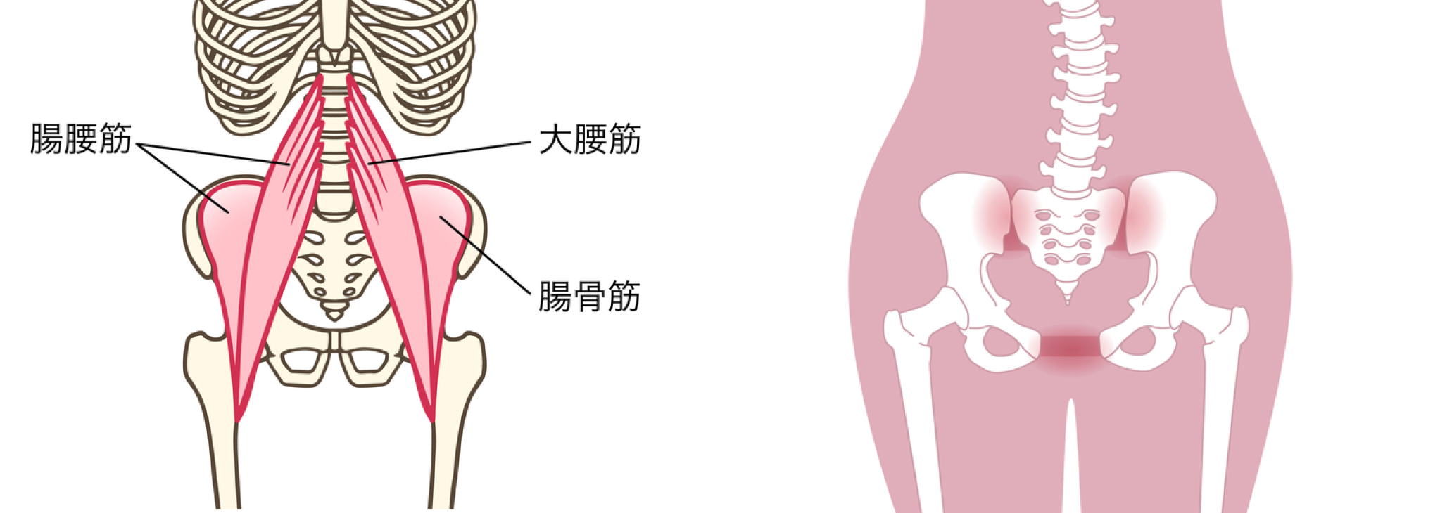 股関節の痛み説明イメージ図