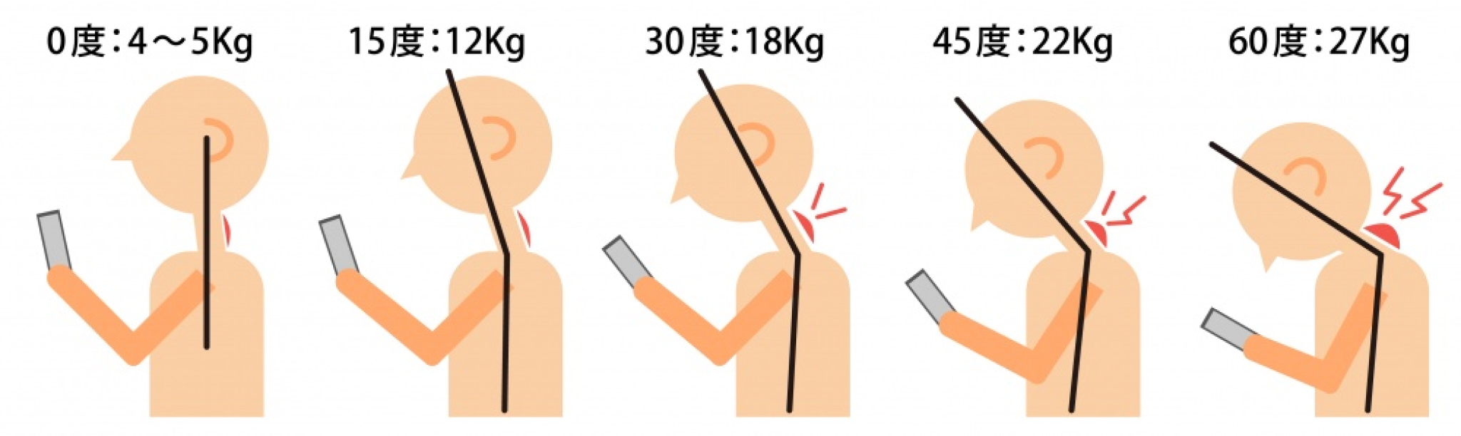 頭部が前傾に変位イメージ図