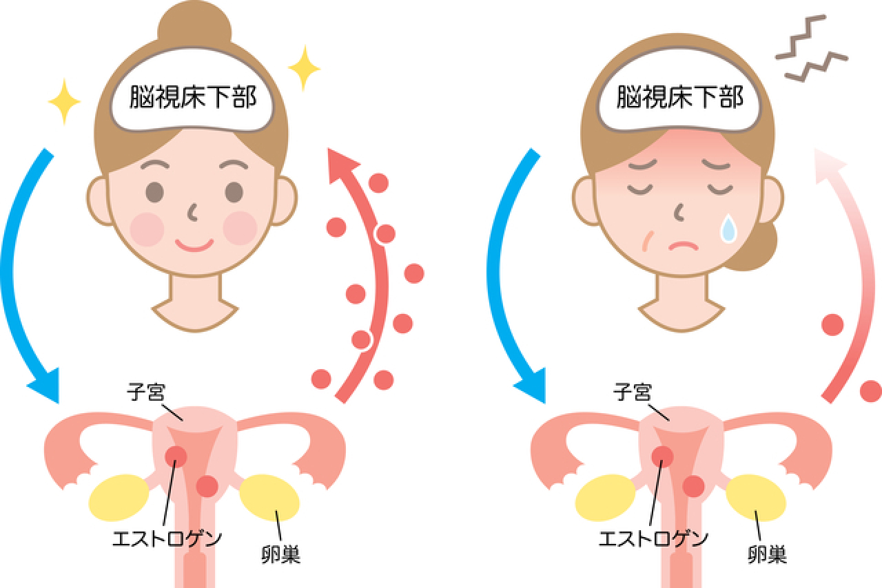 更年期障害 イメージ図